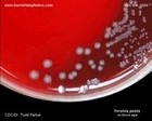 Yersinia pestis colonies